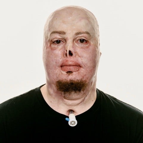 Images by photographer Giles Duley.